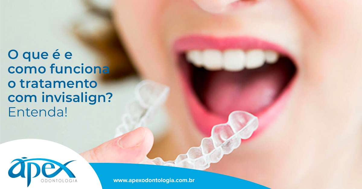 Como Funciona O Tratamento Com Invisalign? Entenda! - Ápex Odontologia