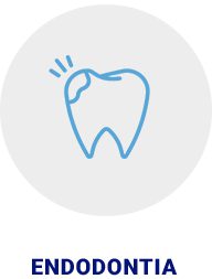 Endodontia | Apex Odontologia