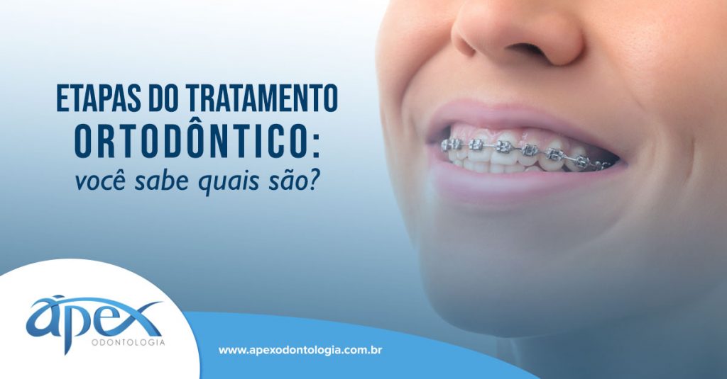 Ao fundo da imagem, há uma mulher sorrindo com aparelho ortodôntico nos dentes.