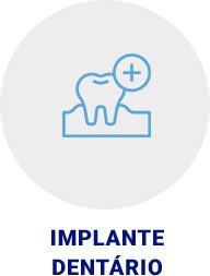 Implante Dentário | Apex Odontologia