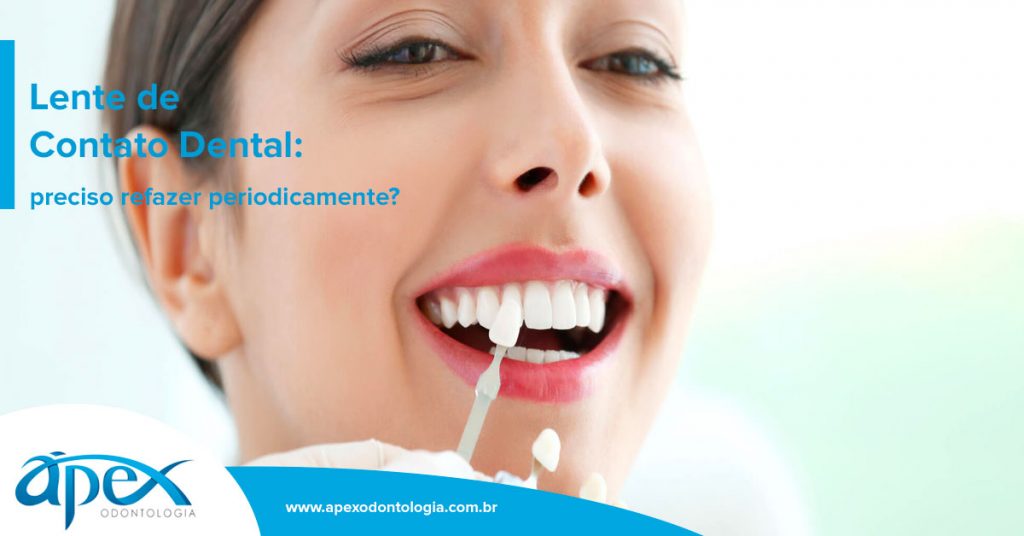 Lente de Contato Dental: preciso refazer periodicamente? | Por Ápex Odontologia | Dentista SP Brooklin