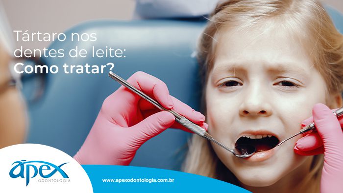 A imagem mostra uma criança e uma mão com luva branca segurando um equipamento de dentista com espelho na ponta dentro da boca da criança.
