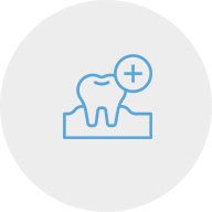 Implante Dentário | Ápex Odontologia