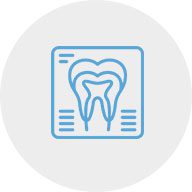 Periodontia | Ápex Odontologia