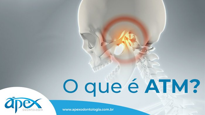 O que é ATM? - Ápex Odontologia, mandibula travada 