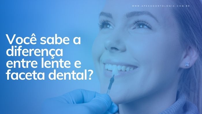 Mulher sorrindo enquanto profissional de saúde, usando luva azul, aproxima uma lente ou faceta dental de seu dente para ajuste estético.